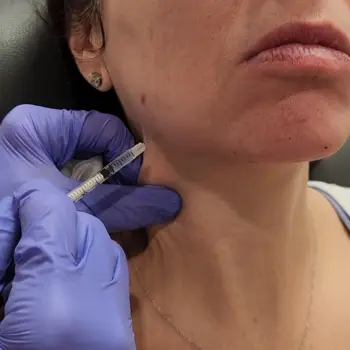 Botox injection along the jawline for lower face contouring at Radiance Medspa