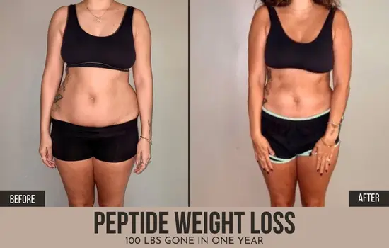 retatrutide before and after pictures Semaglutide + Tirzepatide Atlanta | Weight Loss