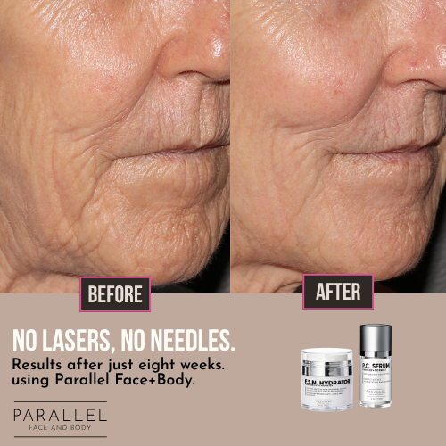 Parallel face and body special september 2026